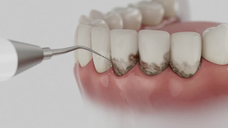 Reliable Dental contractor in Kettering, MD by Smile Center Dentistry